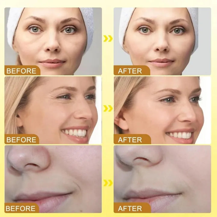 Botox cream