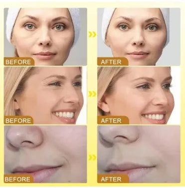 Botox Bee Venom Wrinkle Cream